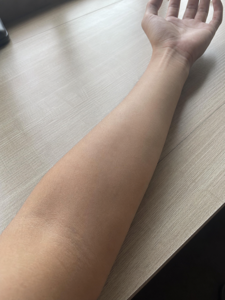 Your photo - bare skin ready for tattoo preview